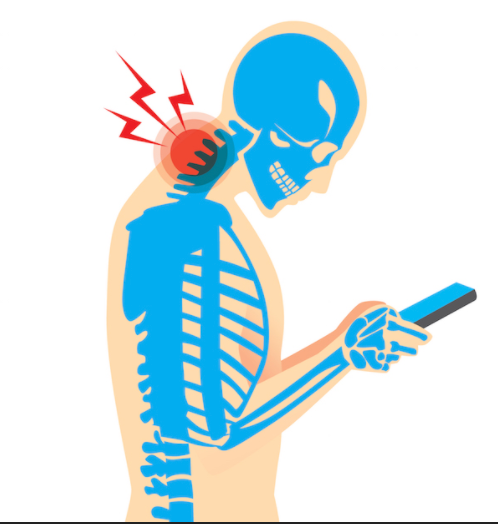 text neck